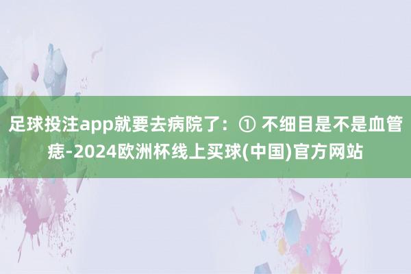 足球投注app就要去病院了：① 不细目是不是血管痣-2024欧洲杯线上买球(中国)官方网站
